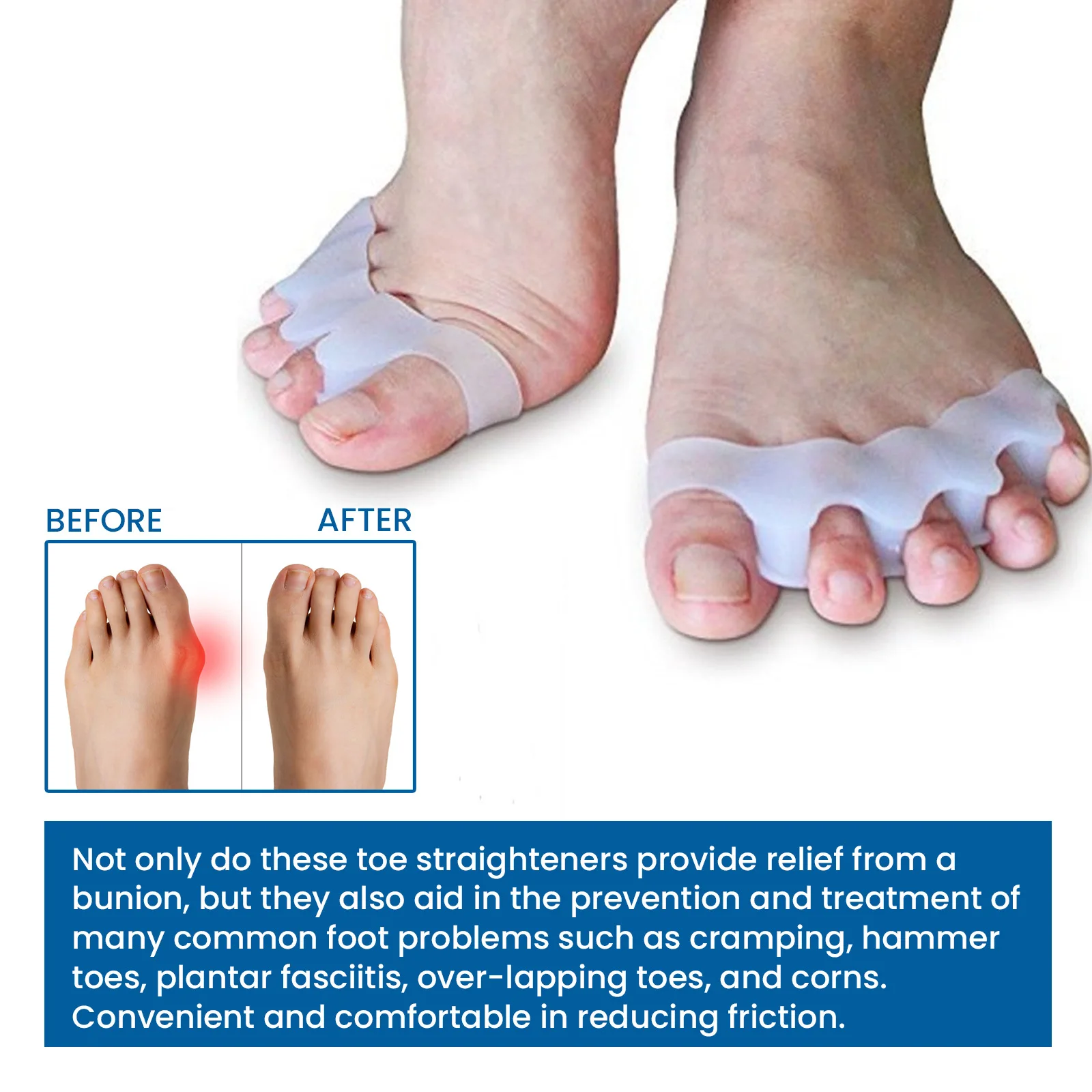 Silicone Finger Toe Protector  - огляд і ціна Yoga Toe Separator