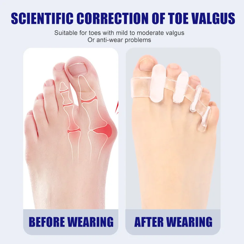 1 Pair Silicone Toe Separator  - огляд і ціна Yoga Toe Separator